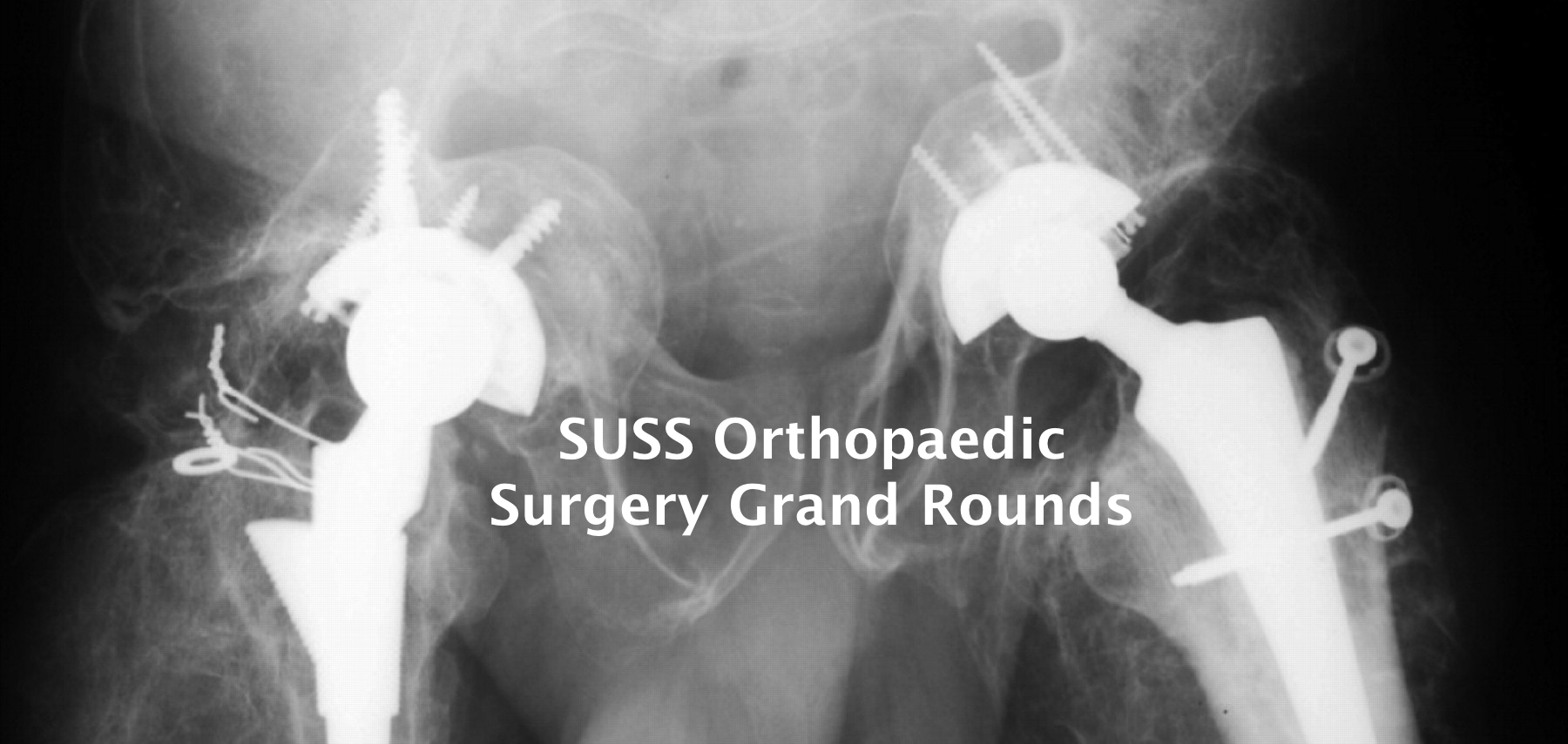 Orthopaedic Surgery Grand Rounds