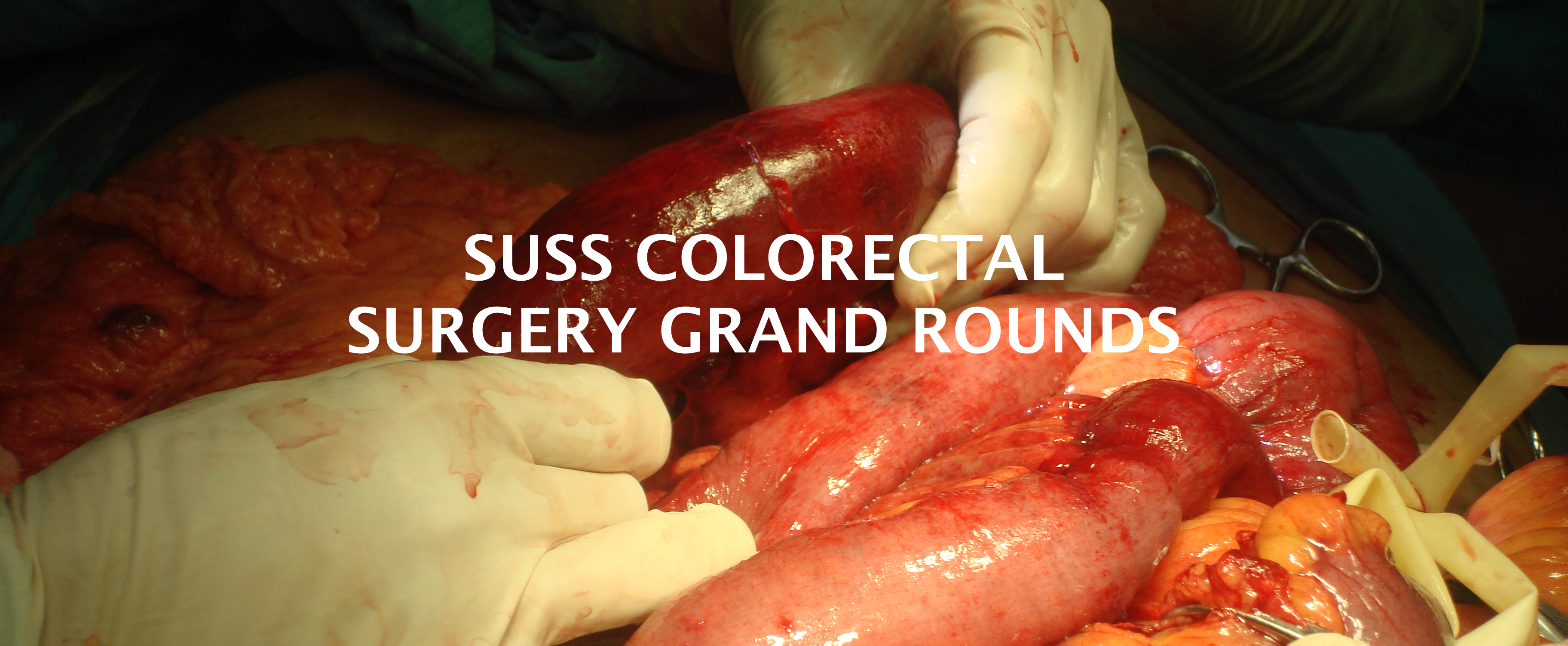 Colorectal Grand Rounds
