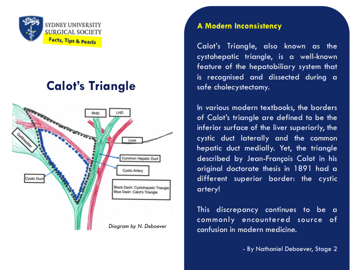 A description of the anatomical borders of Calot's Triangle.